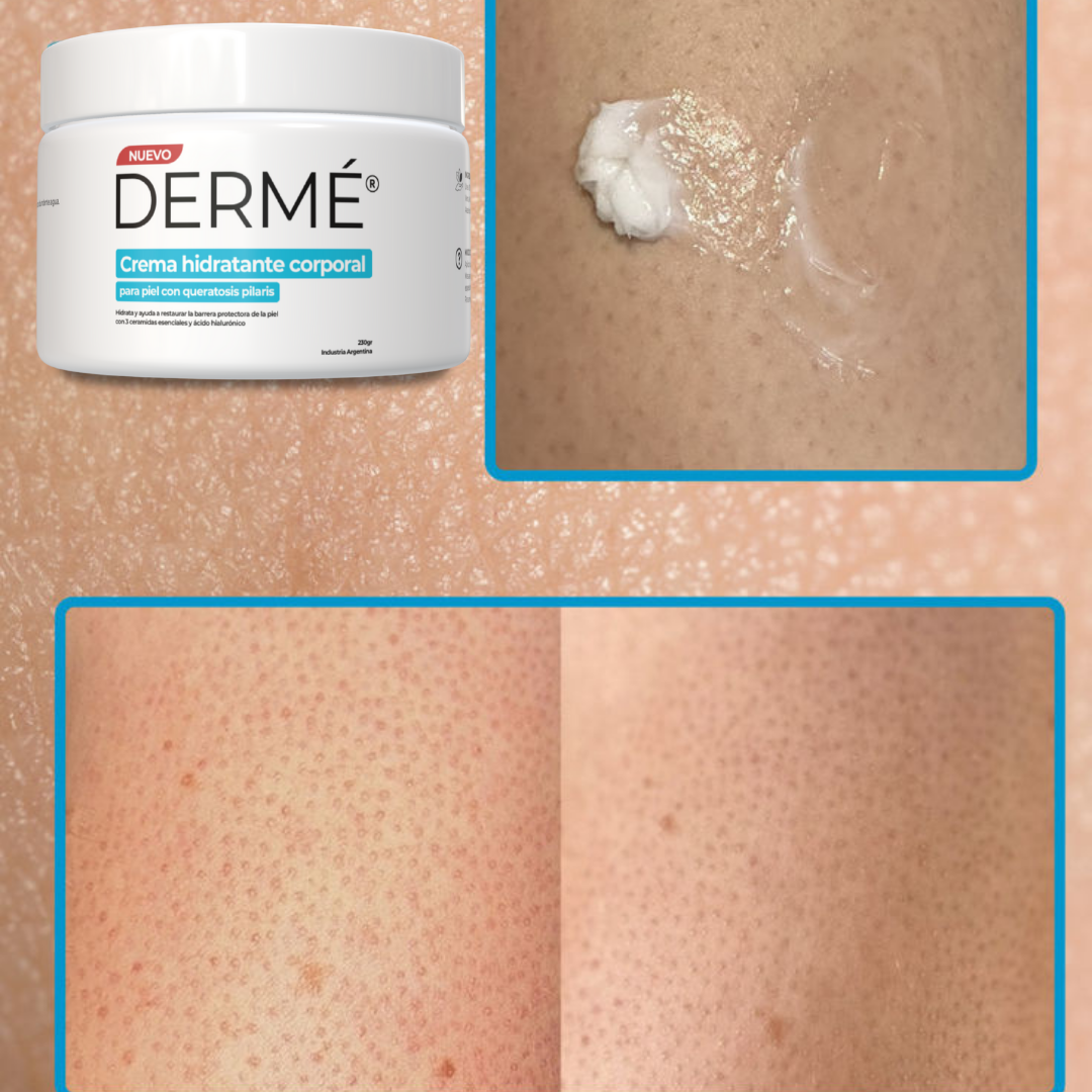 Tratamiento para suavizar la piel áspera y con textura